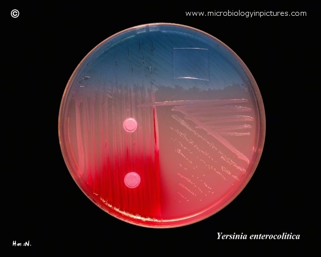 y.enterocolitica, urease test, mannitol fermentation